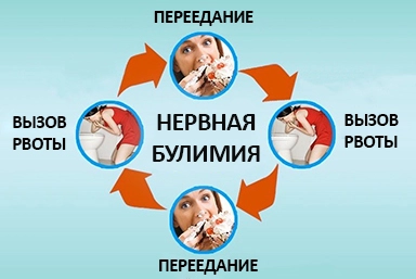Лечение булимии в Гаврилов-Яме